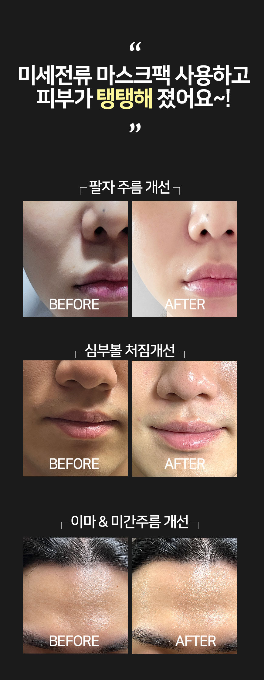DOLDORI ELECDERMA ROLL MASK